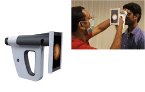 Remidio’s Fundus-ON-Smartphone